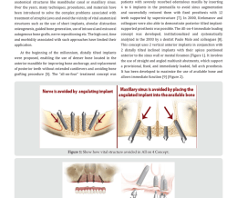 Premier Oral & Maxillofacial Surgery & Dental Implants